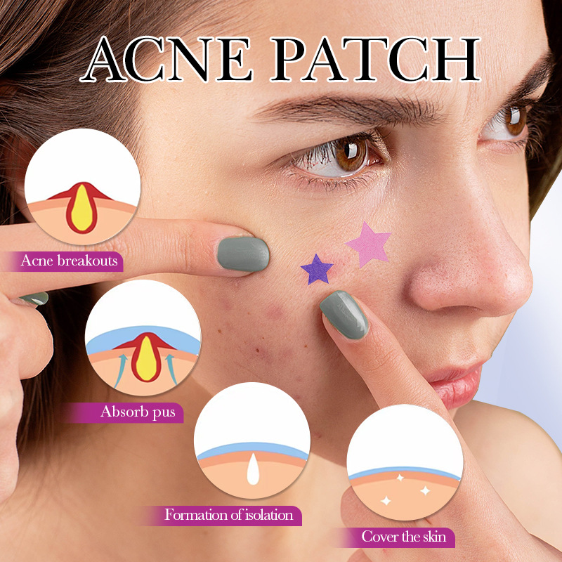 7/10/14 Buah Koyo Jerawat Bint - Skincare Qv ulasan dan harga
